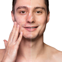 Skin clinic in Goa